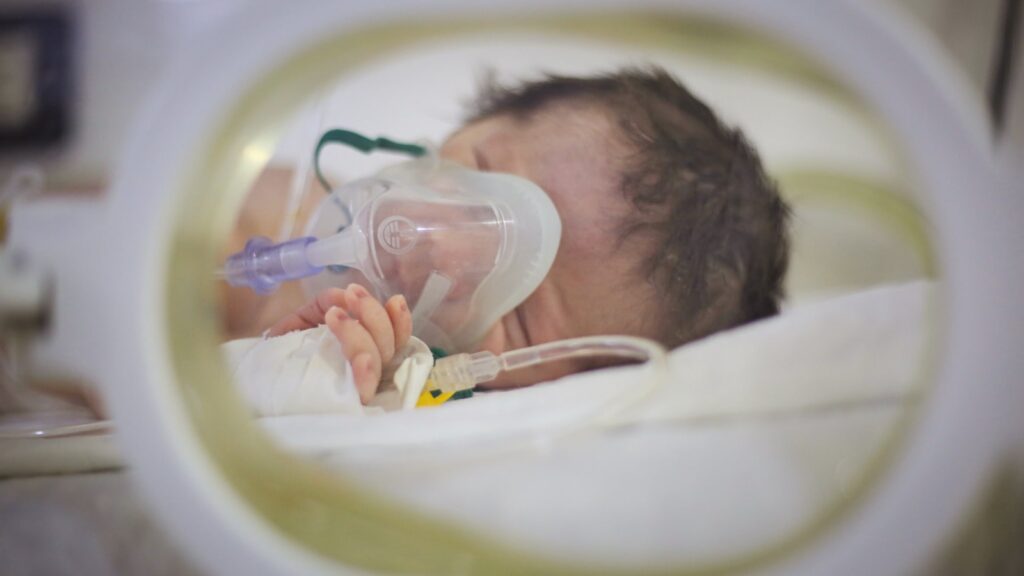 High-Risk Newborn Follow-Up in Indore