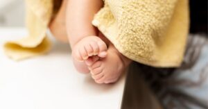 phototherapy services in Indore for baby's yellow tint